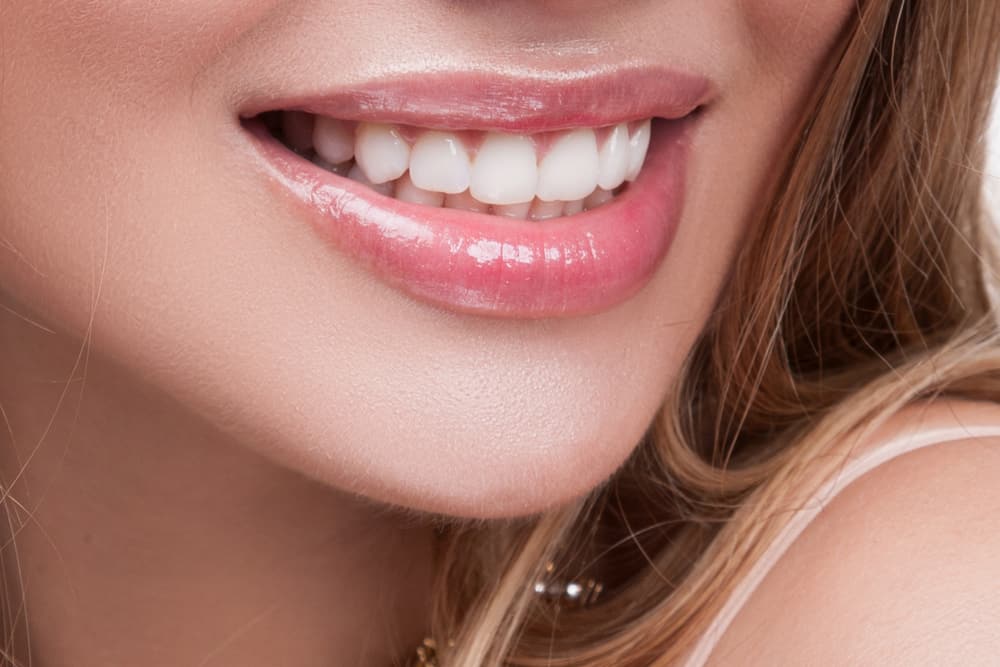 Cosmetic Teeth Whitening: Everything You Need to Know