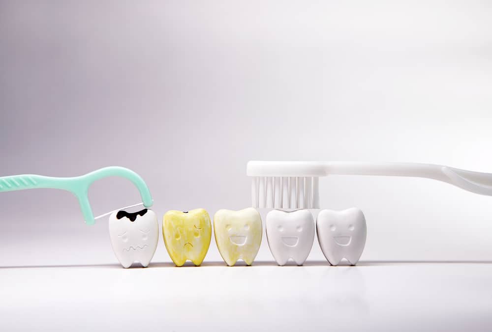 Flossing and brushing your teeth every day Properly can help remove bacterial plaque and food waste. and the accumulation of plaque that causes tooth decay, Cavity, yellow and healthy teeth model